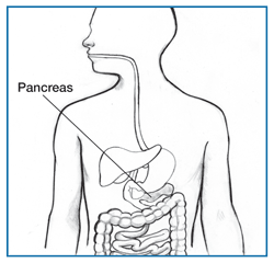 Drawing of a body torso showing the pancreas and part of the digestive system, with the pancreas labeled.