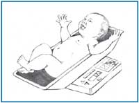Drawing of a newborn baby being weighed on a baby scale. The baby is abnormally large--called macrosomia.